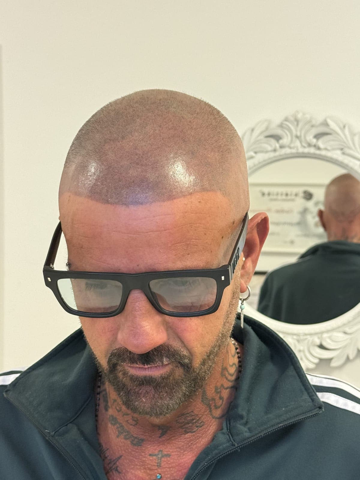 Tricopigmentazione · Inkvidia Fabriano